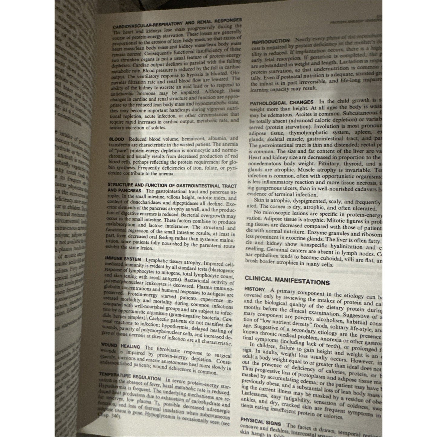 Principles Of Internal Medicine - Kurt J. Isselbacher (Hardcover, 1980)