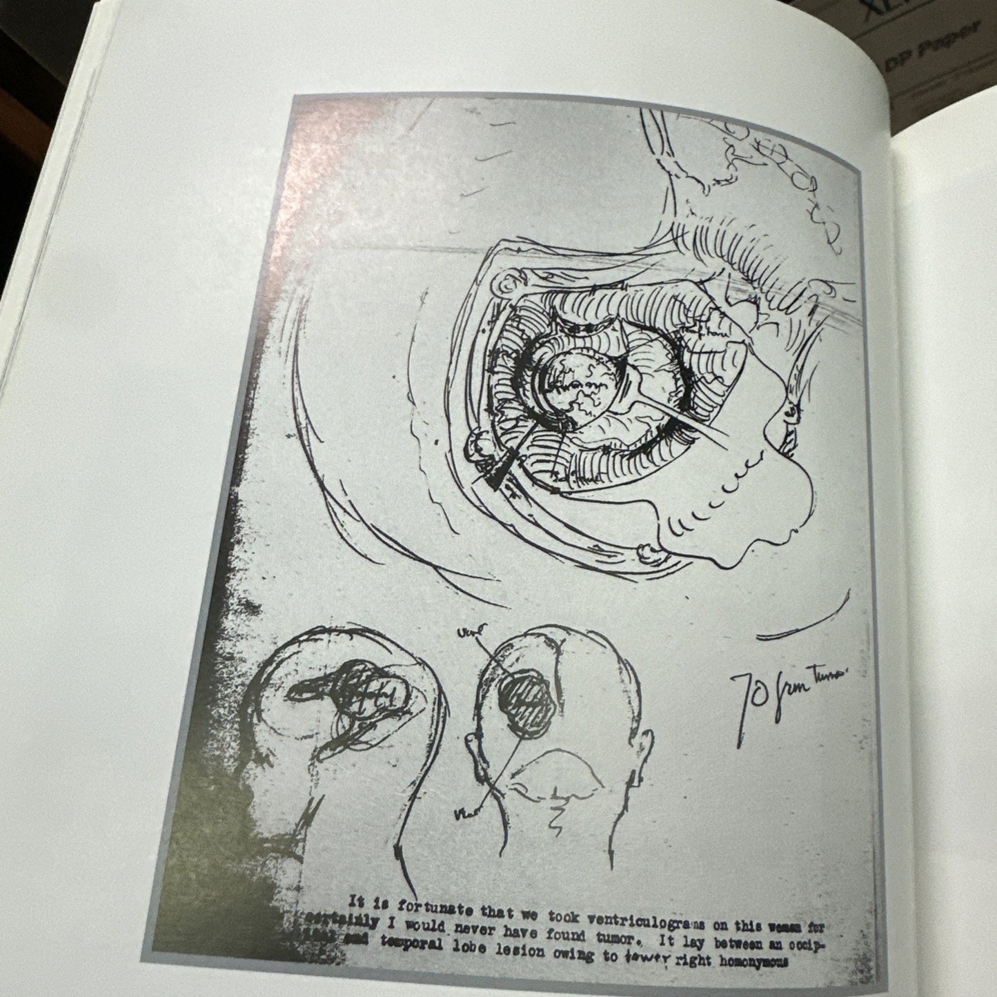 J Lynne Dodson / Century of Oncology Photographic History of Cancer Research 1st