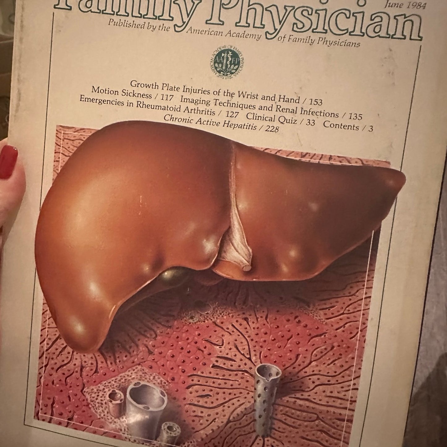4 Vintage American Family Physician Magazines