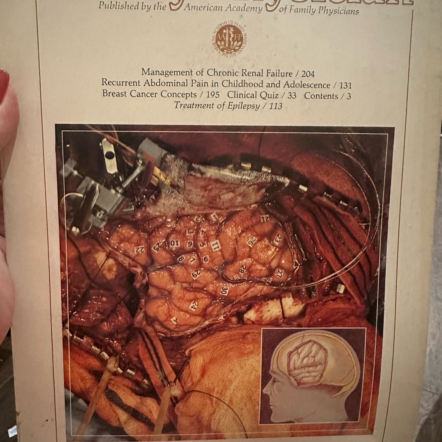 4 Vintage American Family Physician Magazines